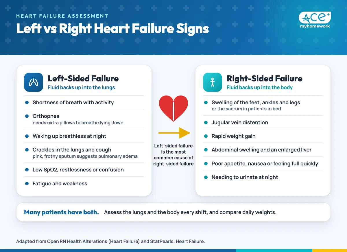 Diagram comparing left-sided heart failure signs such as dyspnea, orthopnea, crackles and cough with right-sided heart failure signs such as leg edema, jugular vein distention, weight gain and abdominal swelling