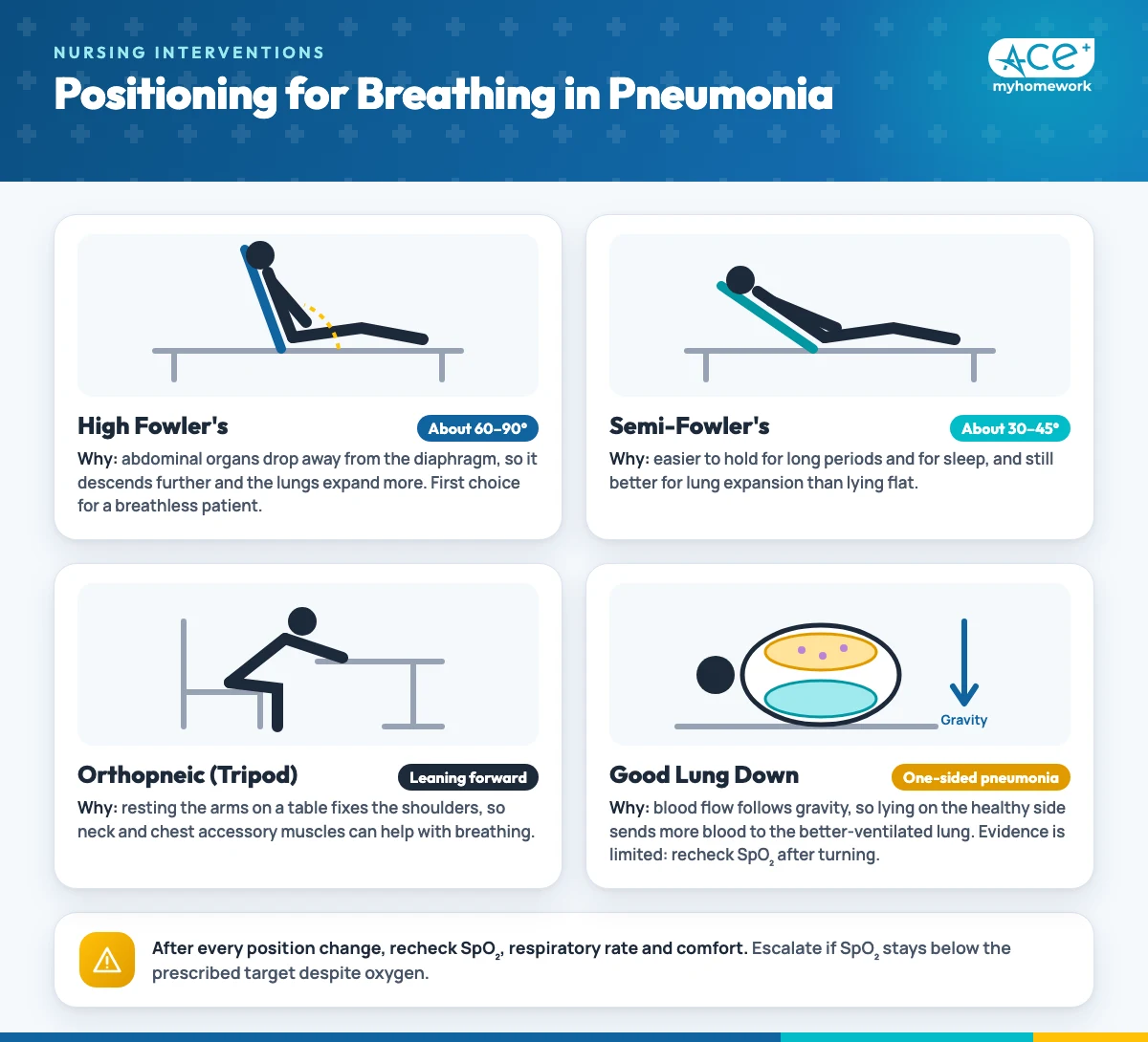 Guide to four positions for breathing in pneumonia: high Fowler's, semi-Fowler's, orthopneic tripod and side-lying with the good lung down, each with its rationale